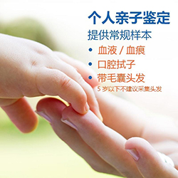 四川私密亲子鉴定需要什么流程，四川匿名亲子鉴定需要怎么做